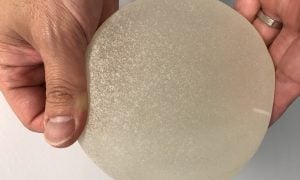 Update On Breast Implant Safety