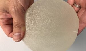 Update On Breast Implant Safety