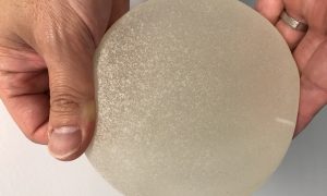 Breast Implant Associated Anaplastic Large Cell Lymphoma (BIA-ALCL) - The Facts?