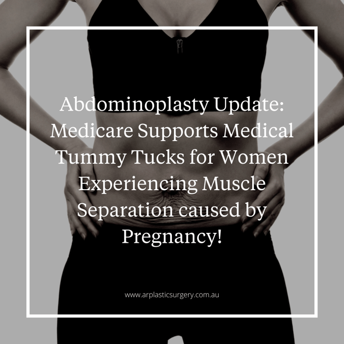 Abdominoplasty Update: Medicare Supports Medical Tummy Tucks for Women Experiencing Muscle Separation Caused by Pregnancy!